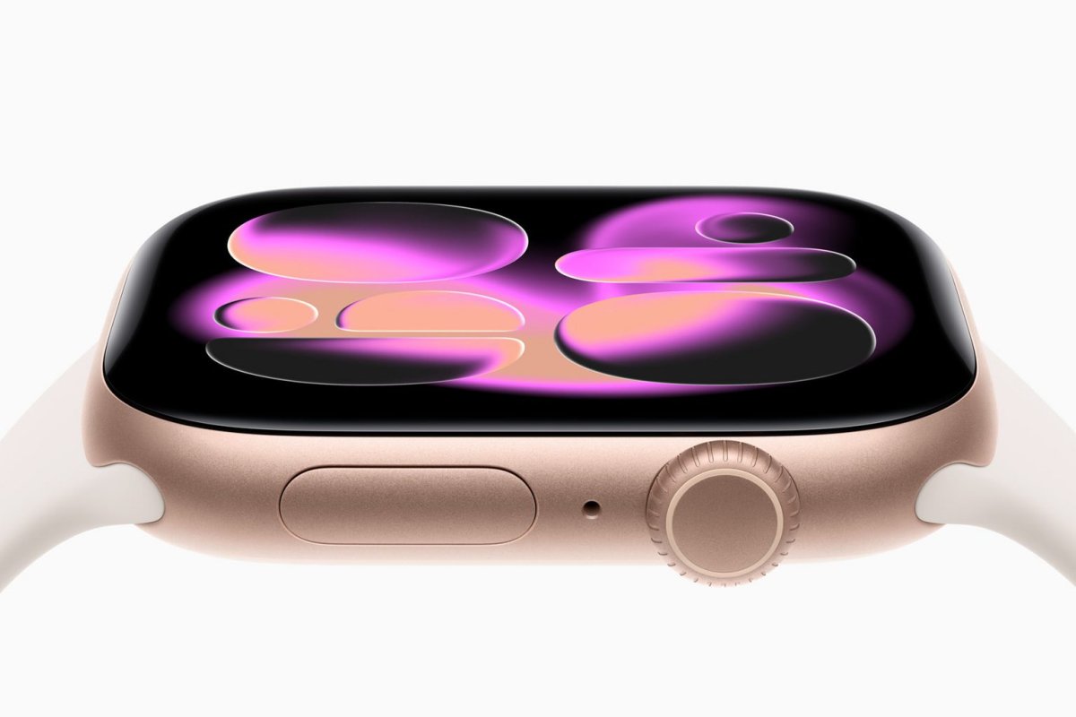 Apple Watch Redesign Rumors Spotlight $7.9B Wearables Business