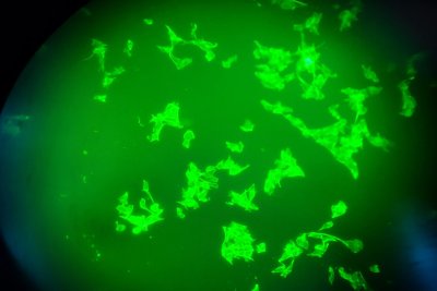 Japan's ABCI-Q Quantum-AI Project to Test Cancer Immunotherapy Designs